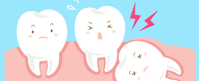 A cartoon of three teeth with different expressions.