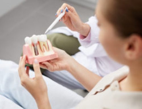 Interesting Facts About Dental Implants