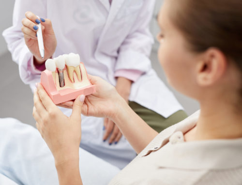 Dental Implants: Choosing the Right Oral Surgeon