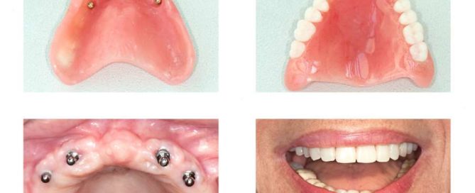 A collage of photos with different types of teeth.