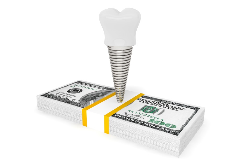 A tooth implant on top of money.
