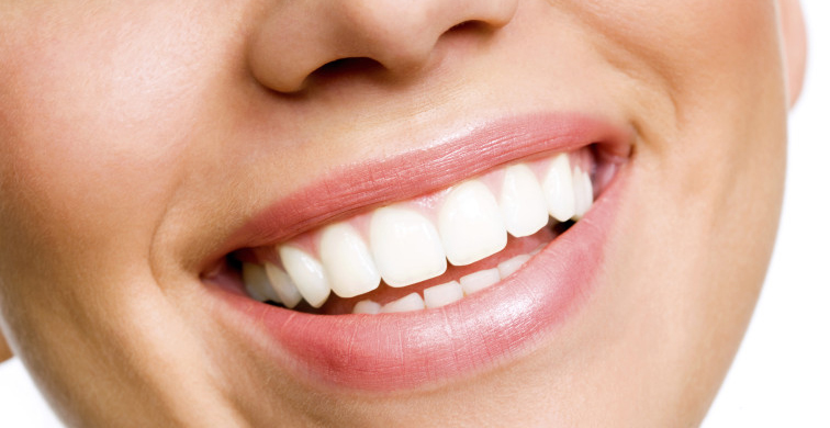 A close up of the teeth of a woman smiling