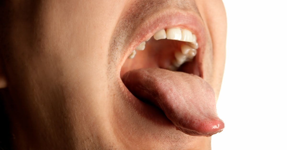 A close up of the tongue and mouth.